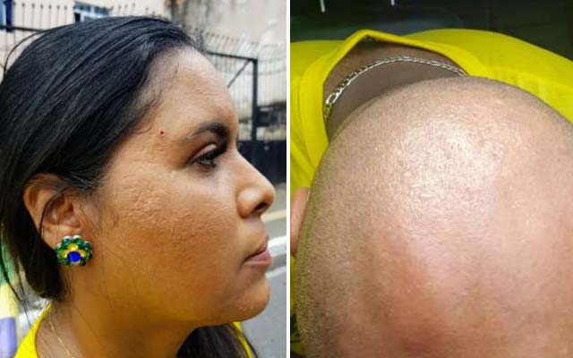 Apoiadores de Bolsonaro são agredidos por membros da esquerda em Salvador; vídeo