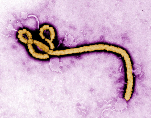 what-is-ebola-virus-symptoms-history-vaccine-in-hindi.