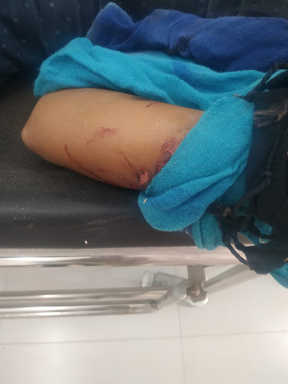 अजमेर में पिस्तौल की नोक पर लूट लिए 82 हजार, लुटेरे अब तक फरार Ajmer News-82-thousand-robbed-at-the-tip-a-pistol-in-Ajmer-the-robbers-still-absconding- अजमेर में पिस्तौल की नोक पर लूट लिए 82 हजार, लुटेरे अब तक फरार