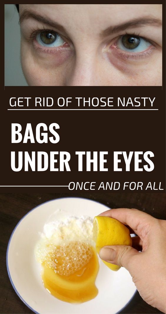 Get Rid Of Those Nasty Bags Under The Eyes Once And For All Heatlhy Scoop