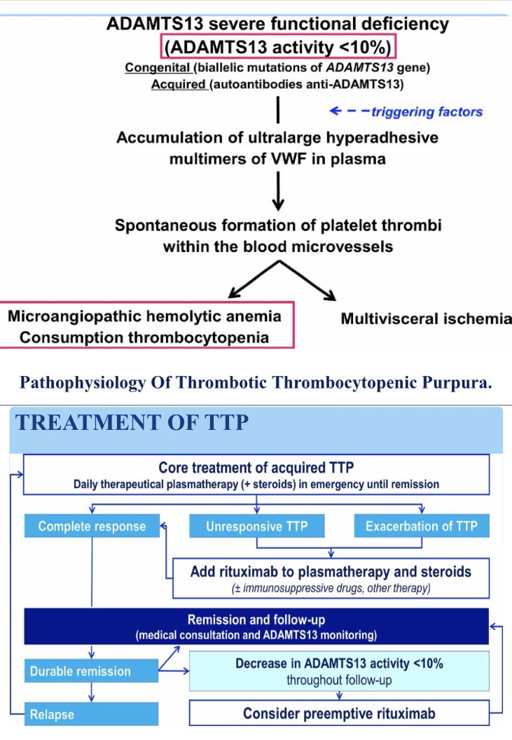 Thrombotic Thrombocytopenic Purpura Ttp
