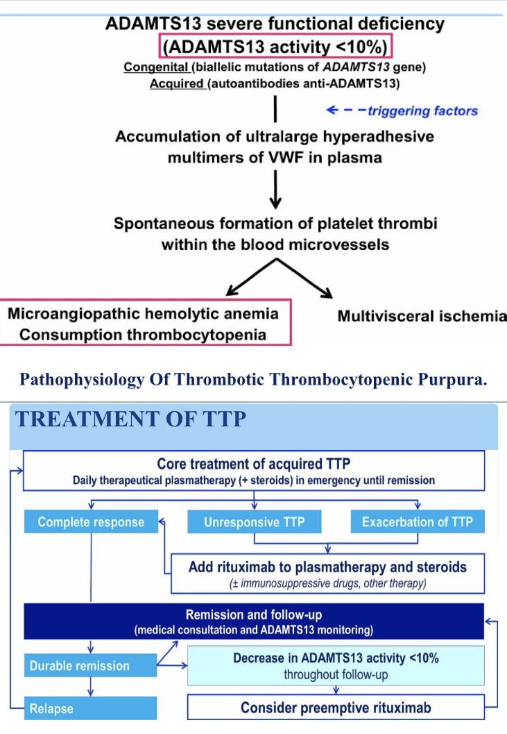 Is Thrombotic Thrombocytopenic Purpura Curable
