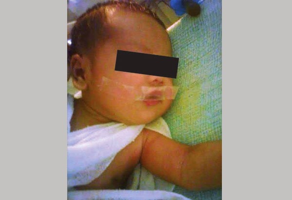Nurse seals baby's mouth with a tape 