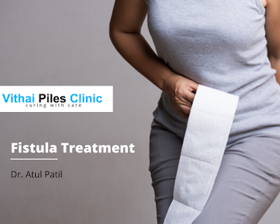 fistula treatment in PCMC, fistula in Ano clinic in pune, fistula in Ano clinic in Pune, laser treatment for fistula, treatment of fistula, ksharsutra, Vithai piles hospital, Vitthal piles centre