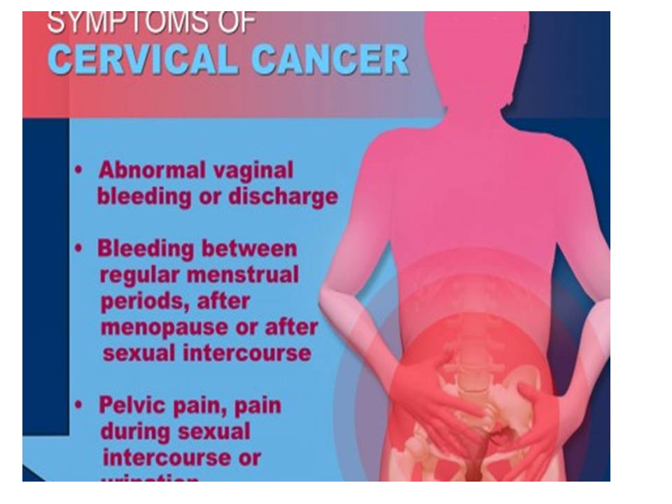 Of warning cervical cancer signs What Are