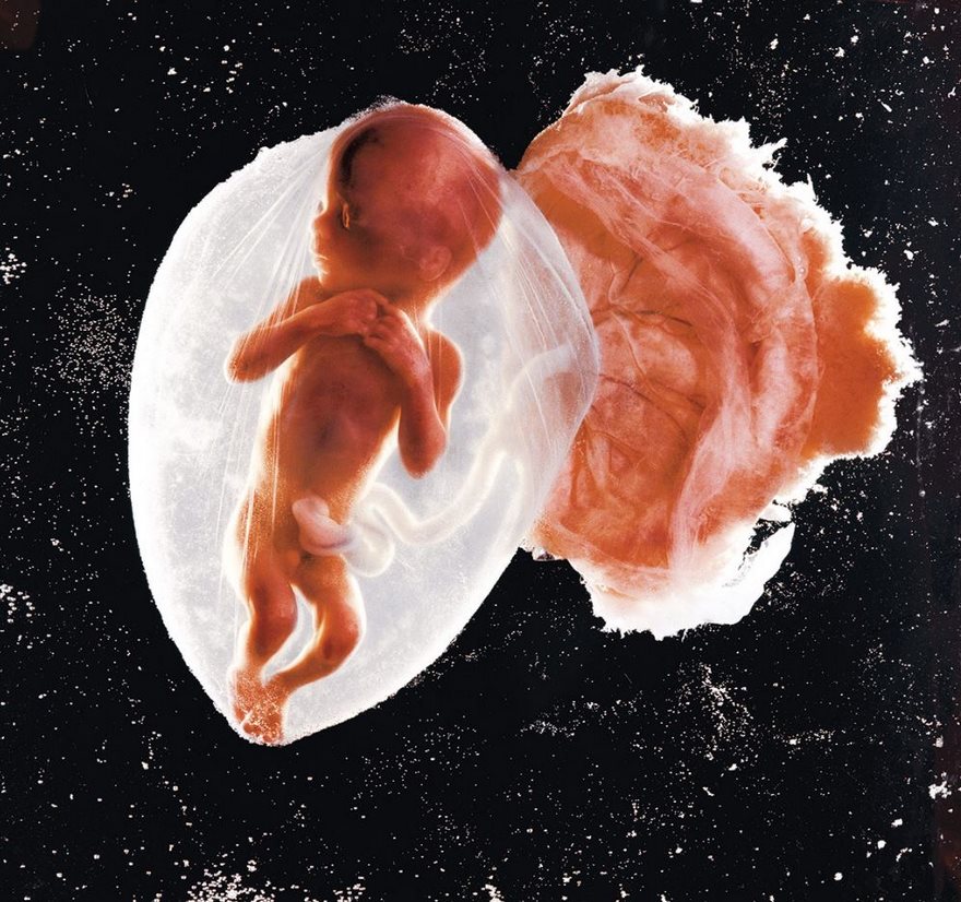 #31 Fetus, 18 Weeks, Lennart Nilsson, 1965 - Top 100 Of The Most Influential Photos Of All Time #31 Fetus, 18 Weeks, Lennart Nilsson, 1965 - Top 100 Of The Most Influential Photos Of All Time