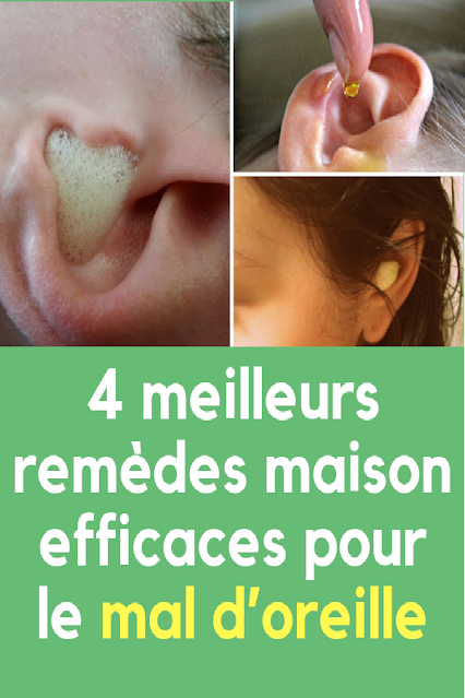 Douleur oreille : 10 traitements naturels contre le mal d'oreille Douleur-oreille-traitements-naturels