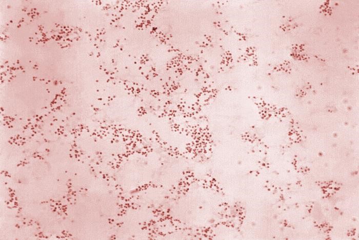 Ixodes Outreach Project July 2020