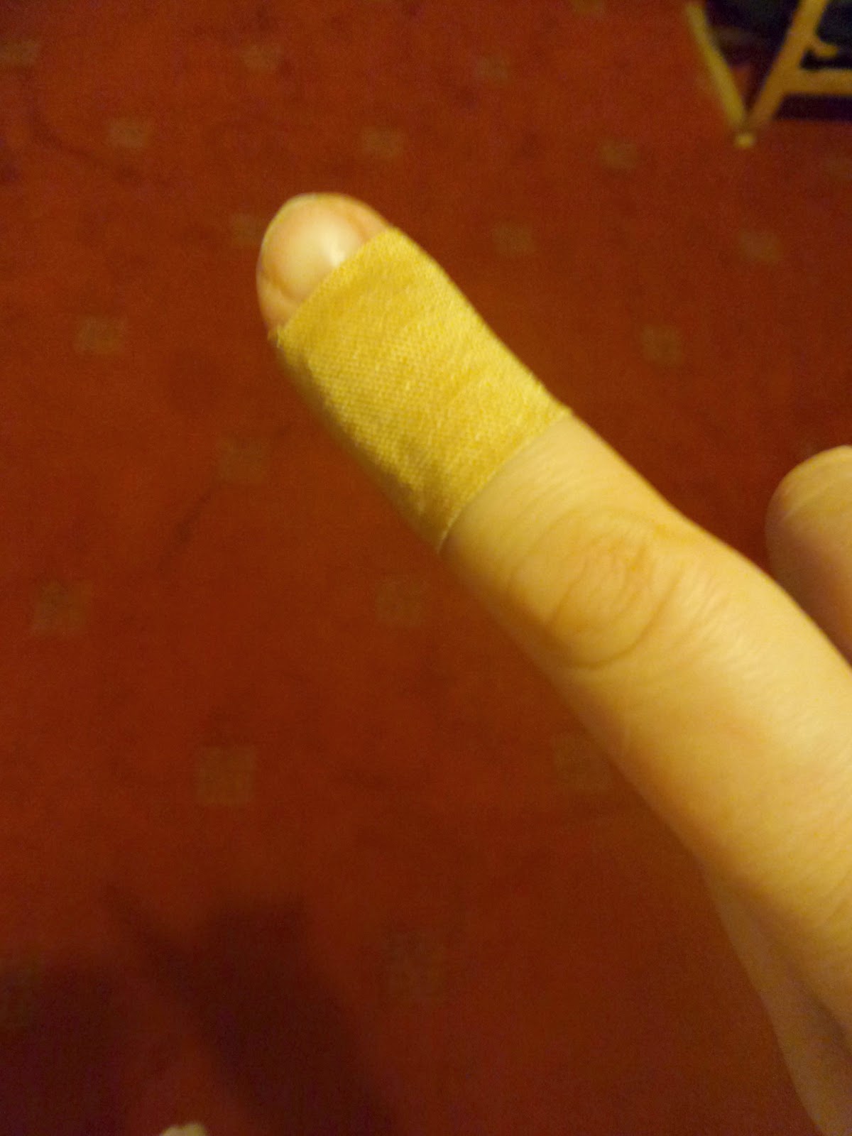 Pippa's Cut Finger - Again!