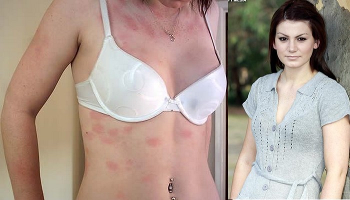 10 People With Strange Medical Conditions