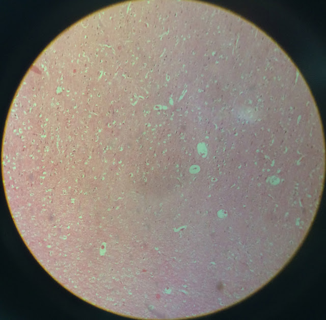 histology slide of cerebrum
