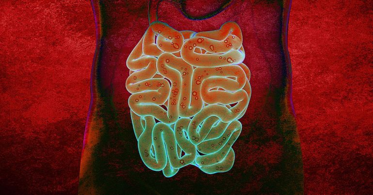 small intestinal bacterial overgrowth sibo small intestinal bacterial overgrowth sibo