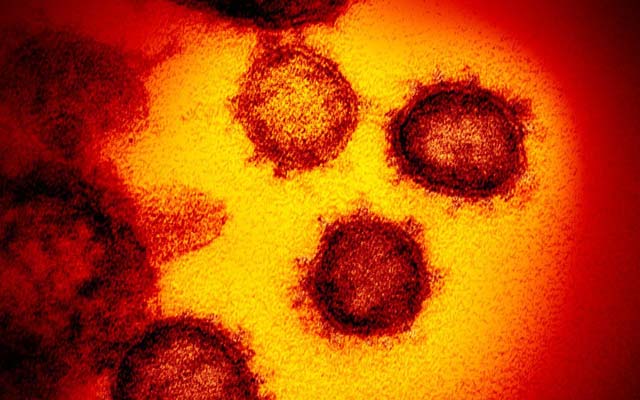 Mulher de 41 anos é a quinta paciente morta pelo coronavírus na Bahia