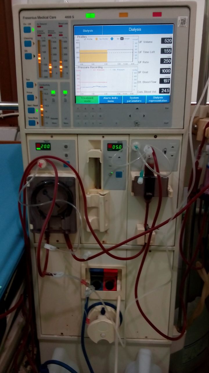 Sejarah Singkat Hemodialisa: Dari Mimpi Buruk Gagal Ginjal hingga Harapan Hidup Sejarah Singkat Hemodialisa: Dari Mimpi Buruk Gagal Ginjal hingga Harapan Hidup