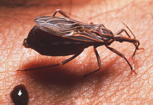 Biology: Chagas Disease (American Trypanosomiasis)