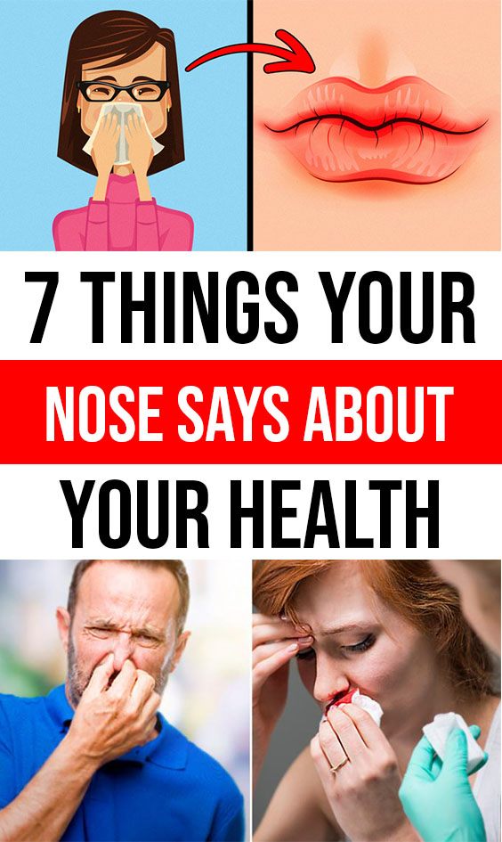 7 Things Your Nose Says About Your Health What That Smell Of Ammonia In 7 Things Your Nose Says About Your Health What That Smell Of Ammonia In