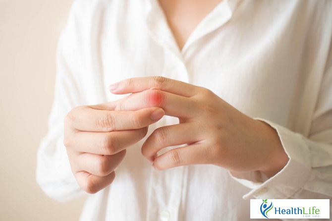 learn more about gout learn more about gout
