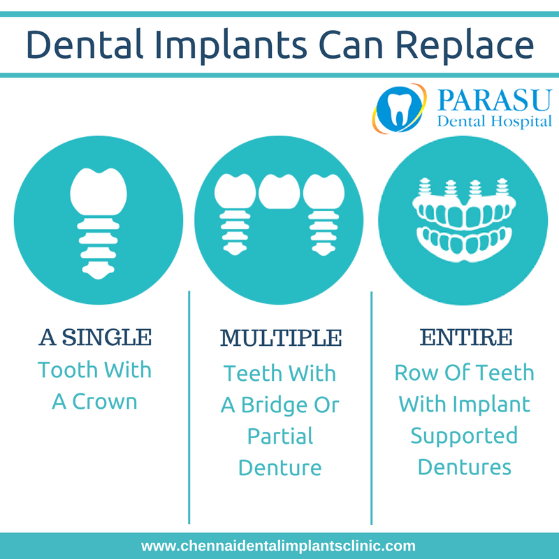 dental implants cost in chennai,India Treatment option for dental