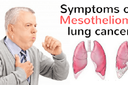 Mesothelioma Information: Some Common Questions About Mesothelioma