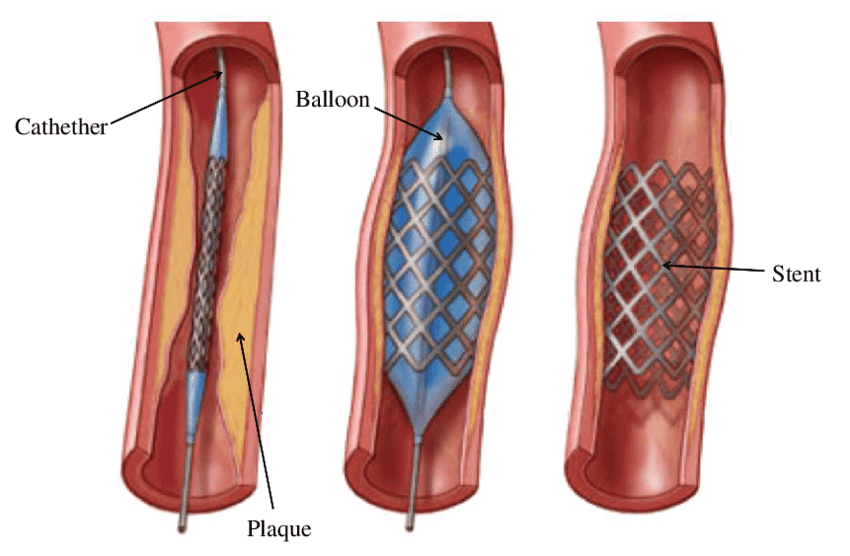 Бог приап статуя. Приапизм форум. Приапизм форум. Бог приап статуя. Приапизм у мужчин что это такое простыми словами.