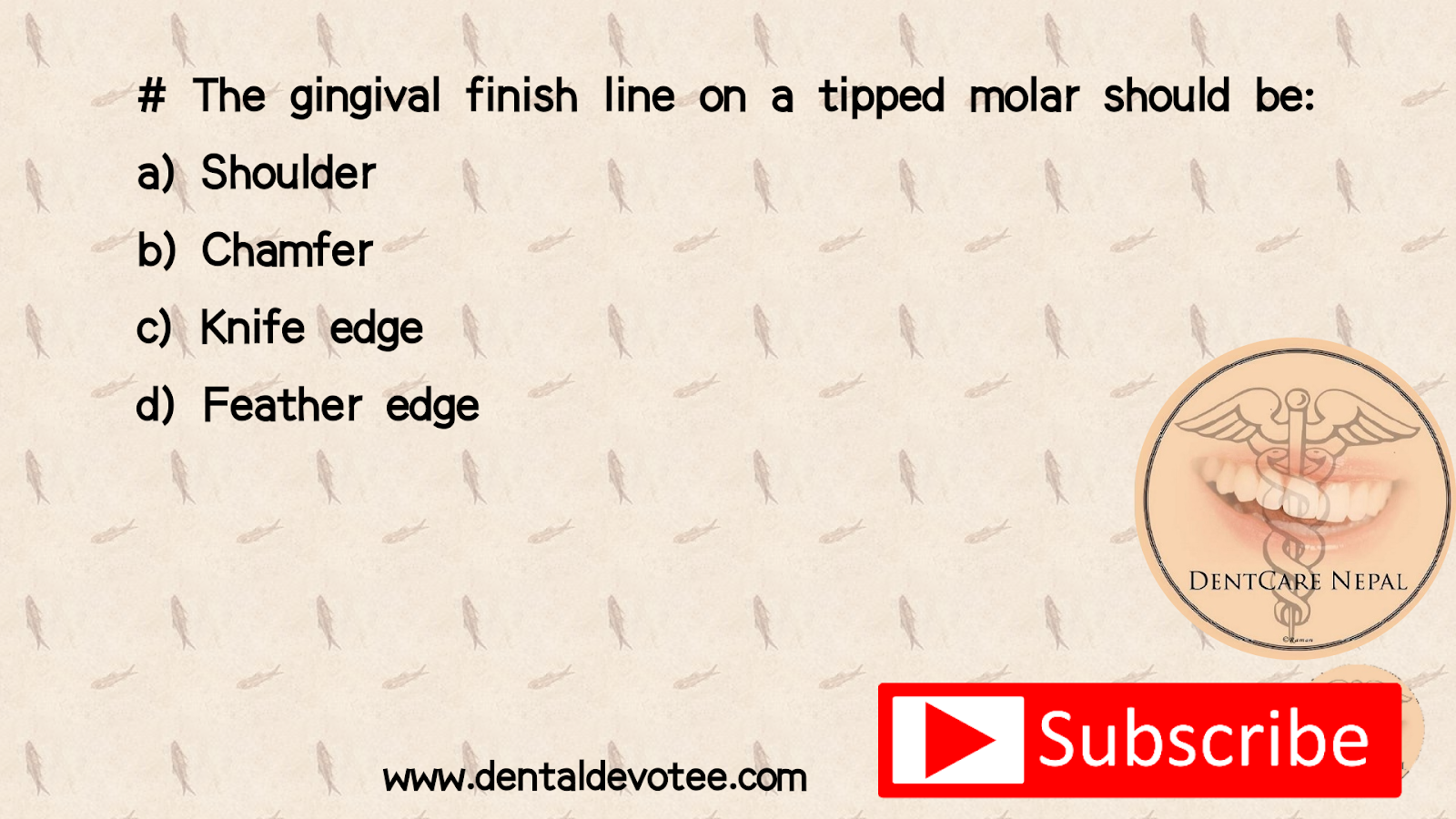 Dentosphere World of Dentistry Gingival finish line on tipped molar