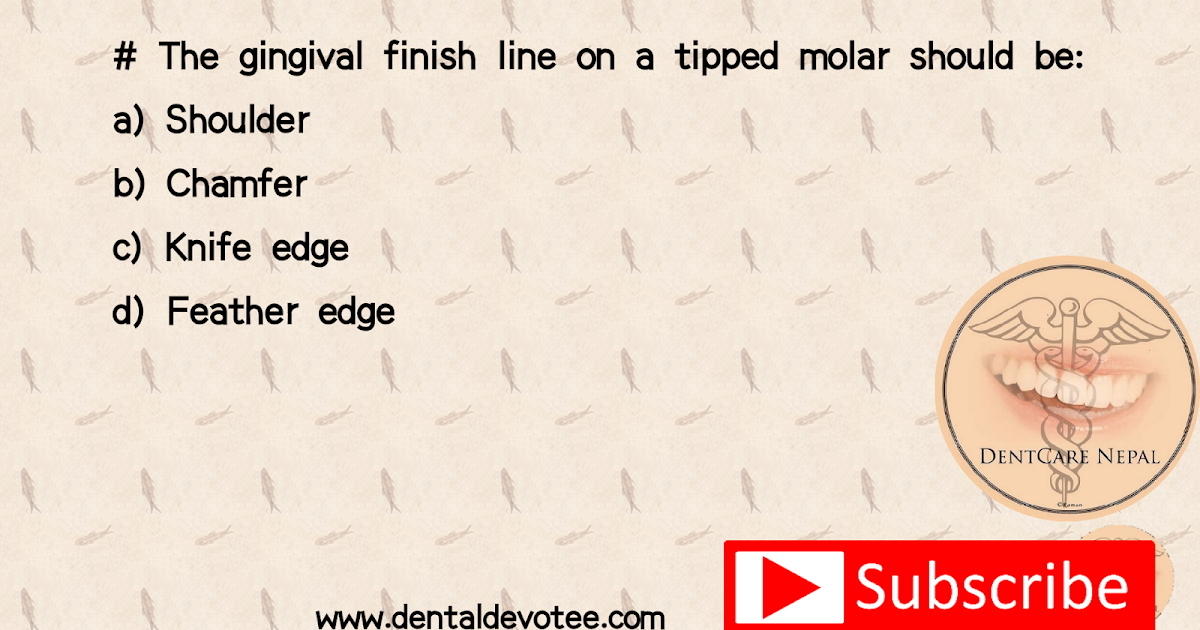 Dentosphere World of Dentistry Gingival finish line on tipped molar