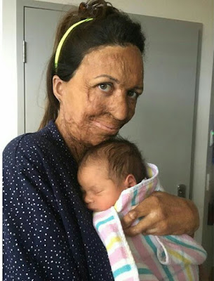 Photos: Burns survivor Turia Pitt and her fiance welcome their first child, a baby boy