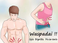 Obat Sipilis Ampuh Alami yang Aman untuk Pria dan Wanita