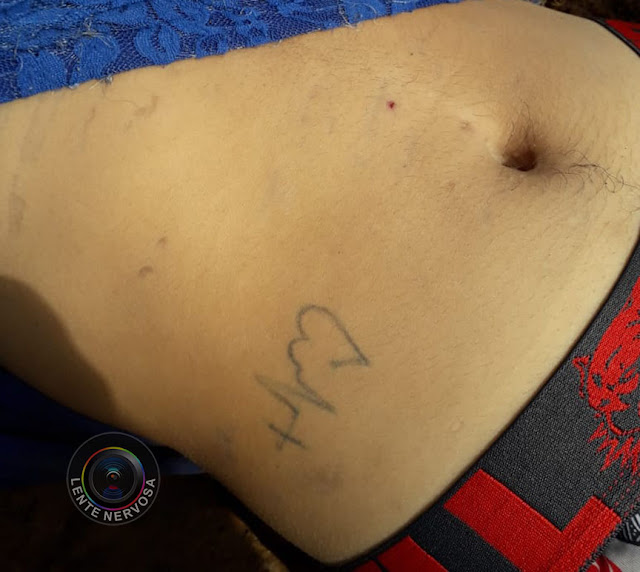 ARLEQUINA – Corpo de jovem encontrada morta possui tatuagens e aguarda por reconhecimento no IML - VEJA FOTOS