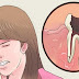 Une astuce naturelle pour soulager un mal de dents