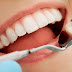 Ưu điểm khi bọc răng sứ cho răng móm