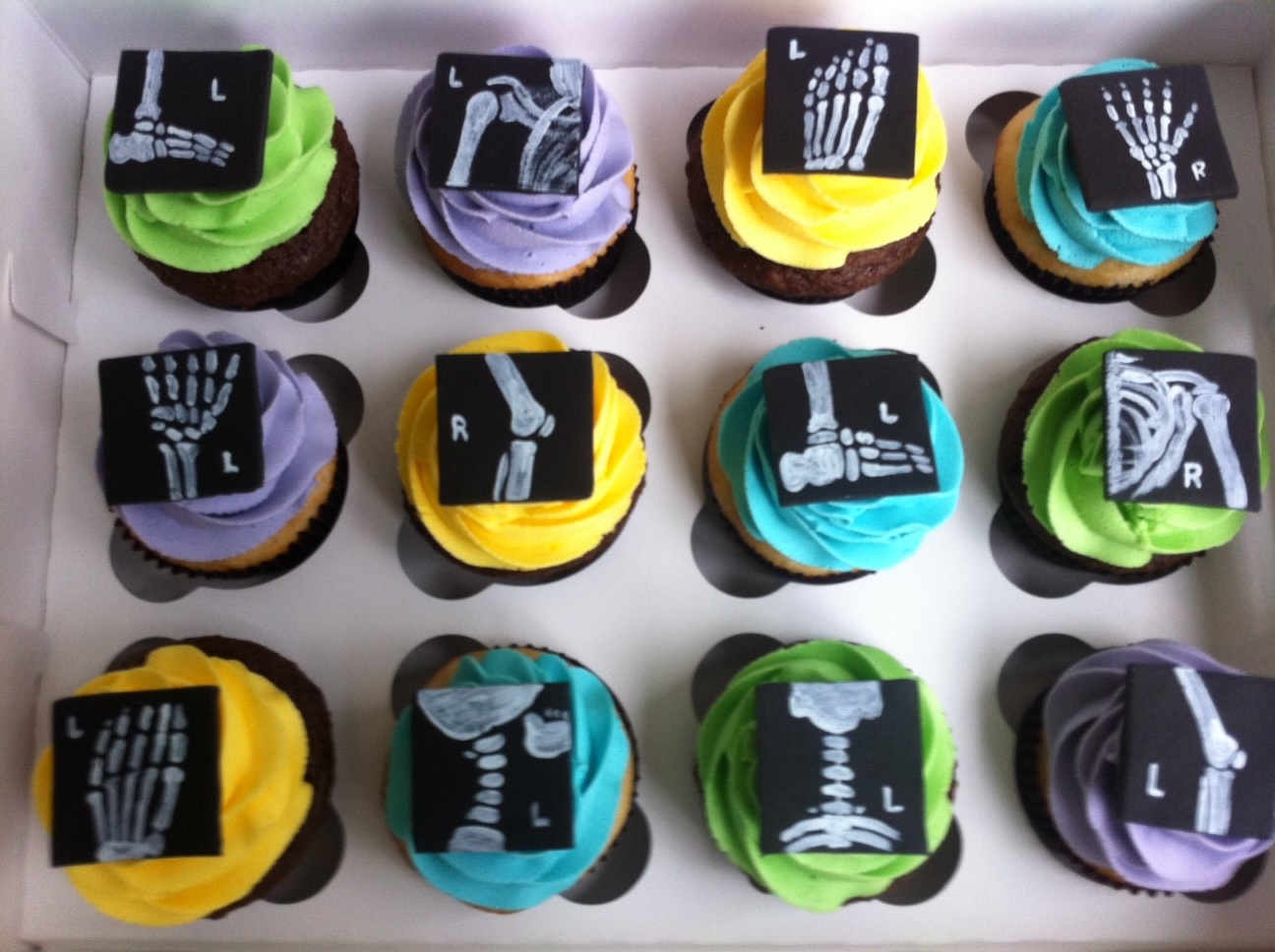 Just Delightful Cakes XRay Cupcakes
