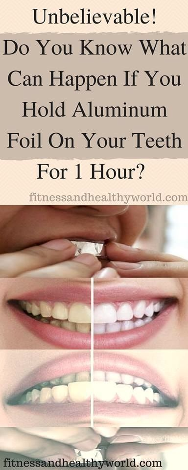 foil unbelievable aluminum teeth hour hold happen know whitening effects doesn same