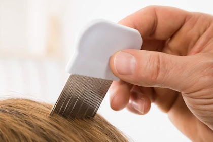 مشط القمل | كيفية استخدام مشط القمل المعدني