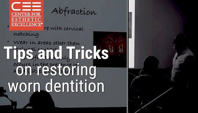 WEBINAR: Tips and Tricks on Restoring Worn Dentition - Dr. Margeas