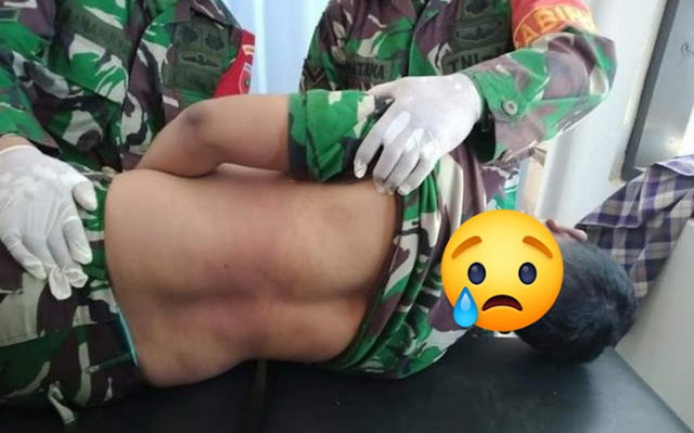 Penyebab Kematian Anggota TNI Serda Rusdi Dibeberkan Komandan Korem 143/HO, Ini Katanya