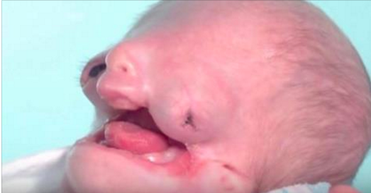 Ce pauvre bébé est abandonné à sa naissance, mais jetez un coup d'oeil à ce qu'elle est devenue 6 ans plus tard!