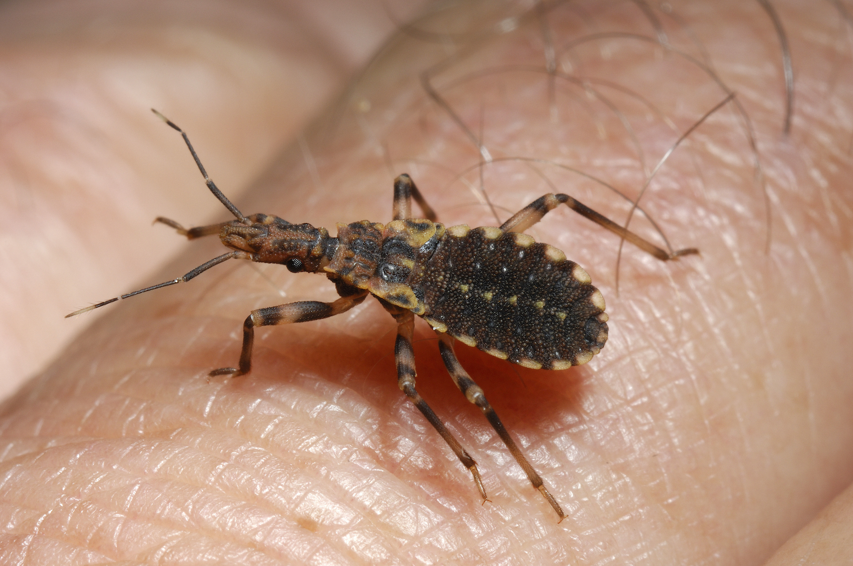 les-maladies-tropicales-n-glig-es-la-maladie-de-chagas-africa-green