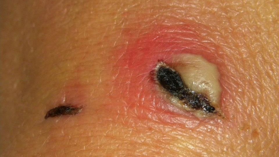 Healing Dog Wounds Naturally Healing Dog Wounds Naturally
