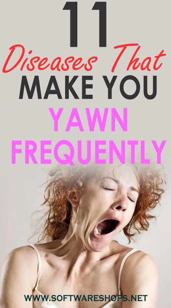 11 Diseases That Make You Yawn Frequently