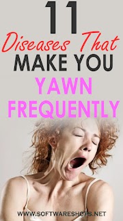 11 Diseases That Make You Yawn Frequently