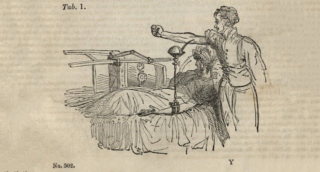 Рисунок в статье Джеймса Бланделла «Наблюдения при переливании крови», 1829 год