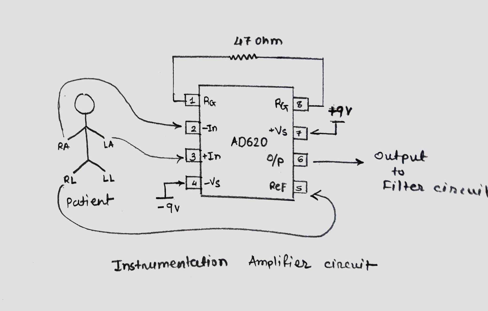 Make your own Realtime, Lowcost and Portable ECG Device
