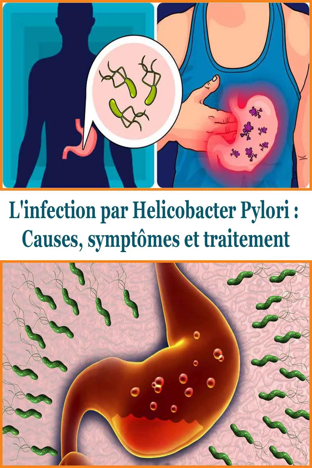L'infection par Helicobacter Pylori : Causes, symptômes et traitement