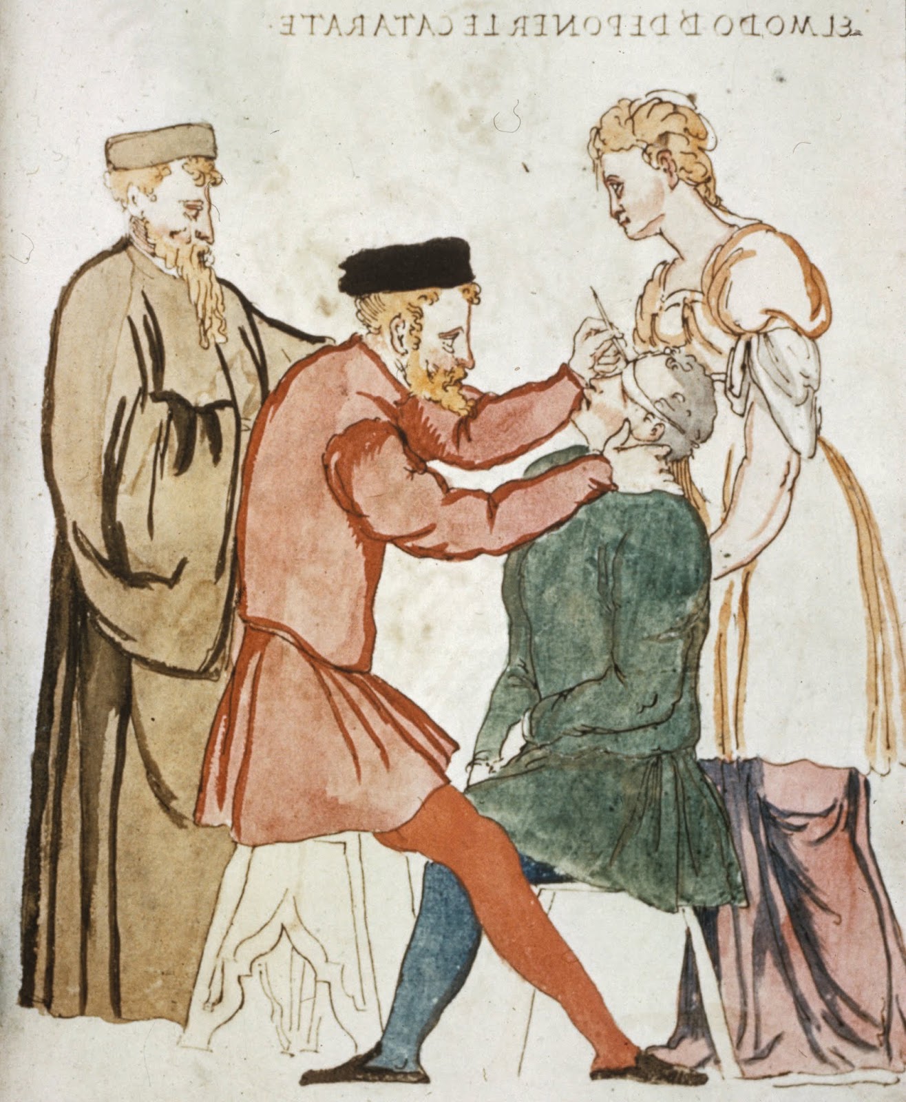 Хирургия эпохи возрождения. Реклинация катаракты в древности. Средневековая медицина медики средневековья.