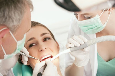 Răng bị sâu sau sinh bao lâu thì được nhổ răng?-2