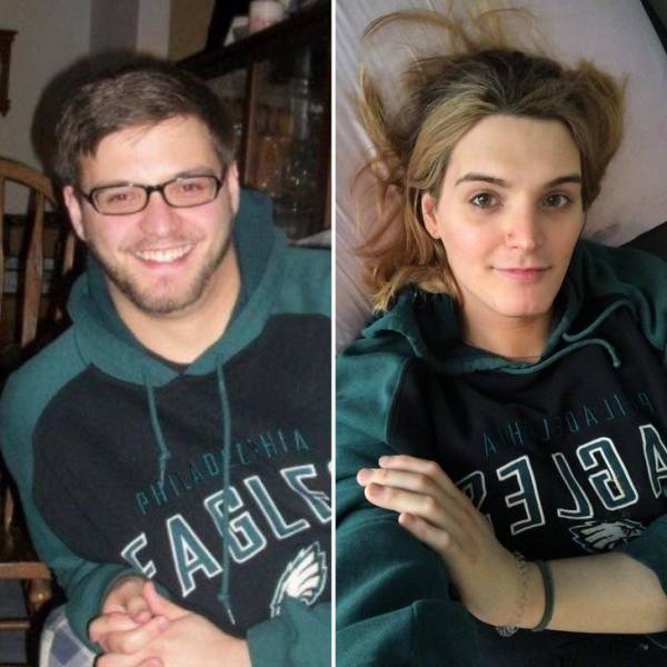 Gender Change Before and After Surgery Sex change Operation Amazing