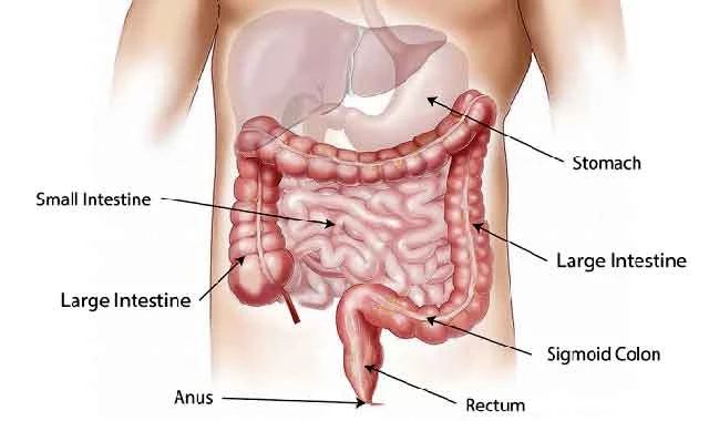 Treatment of IBS Patient in Homeopathy