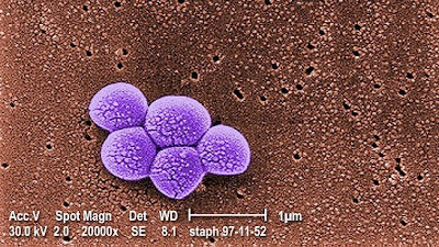 Methicillin-resistant Staphylococcus aureus mrsa