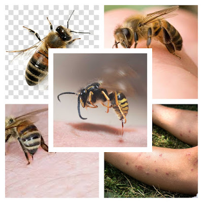 Bee Stings and Allergy